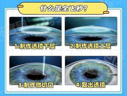 三、中山大学眼科中 心预约后，这些“就诊细节”别忘yanke.yadoo.cn