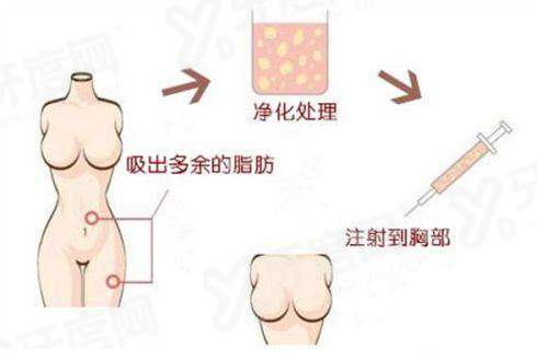 二、李世荣延长手术厉害吗yanke.yadoo.cn