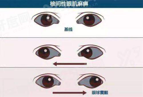 三、深圳希玛林顺潮眼科医院做白内障手术，价格和预约怎么弄？yanke.yadoo.cn