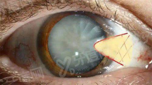 一、梅州爱明眼科医院院长是谁？钟世强yanke.yadoo.cn