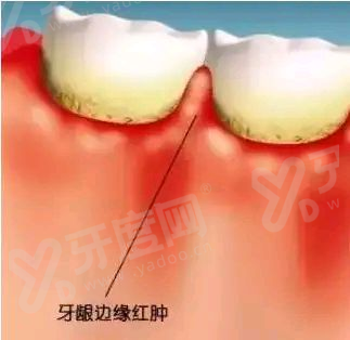 四、佛山欧阳玉甜口腔医院预约挂号方式yanke.yadoo.cn