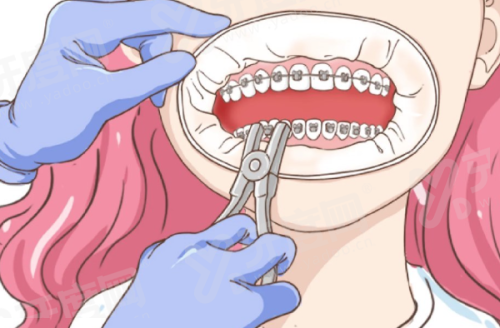 一、东莞桥头牙科哪里比较好yanke.yadoo.cn