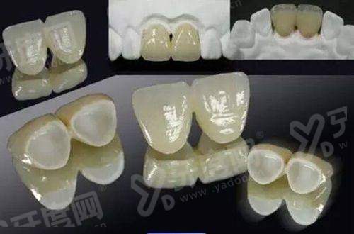 上海西朗美口腔医院怎么预约挂号？线上/电话约！种植矫正口碑好，青浦区华新镇华强街