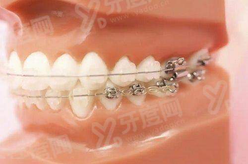 三、yanke.yadoo.cn