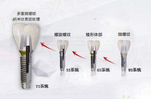 四、南平延平植雅口腔医院预约挂号方式与坐诊医生yanke.yadoo.cn