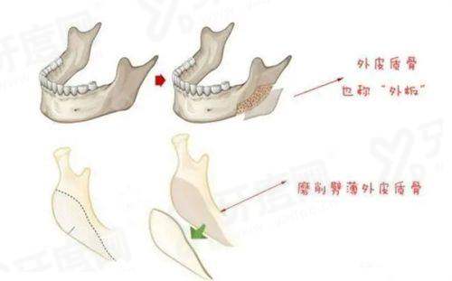 广州青逸打CGF生发多少钱一针？基础CGF3k/小面积脱发3.5k元起