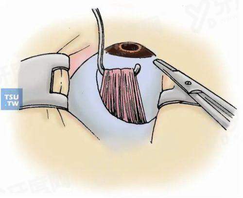 三、岳阳恒康眼科医院价格表？（收费透明公开，性价比高）yanke.yadoo.cn