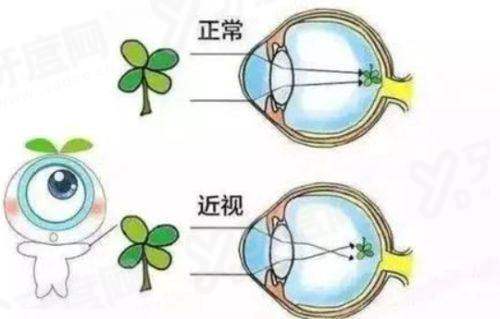 三、北京同仁眼科前十医生生预约挂号攻略？（多种挂号方式及操作流程，附优势分析）yanke.yadoo.cn