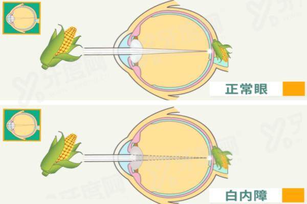 银川西门桥眼科医院怎么样？实力口碑强，价格表+地址全公开，看眼必看！