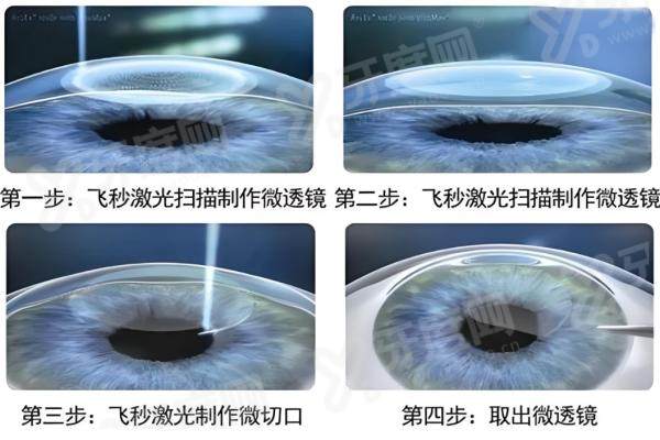 当兵做半飞秒和全飞秒哪个好？特战选全飞秒更抗冲击！3步攻略教你选