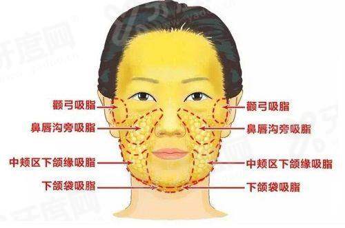 二、韩国热玛吉的功效yanke.yadoo.cn