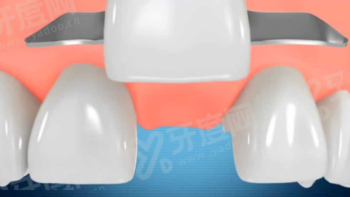 二、无锡北极星口腔医院医生介绍：罗新宇/孙世喜/张明宇yanke.yadoo.cn