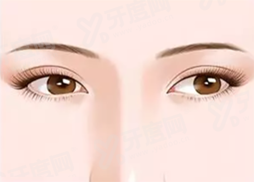 陈凤超医生大拉皮价格揭秘：含全方位/中面部/下面部价格