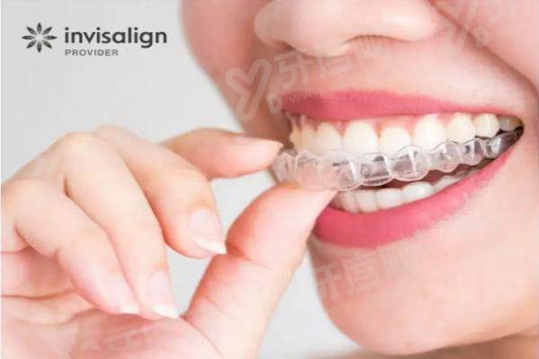 青岛中诺口腔隐形矫正多久能看到明显效果？1-3个月见初步变化，1年以上明显变化！时间节点全解析附价格