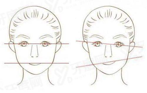 二、王春虎面部提升怎么样yanke.yadoo.cn