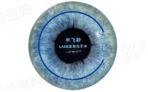 童视康哺光仪多少钱？基础款1500/升级款2500/高端款3500元起