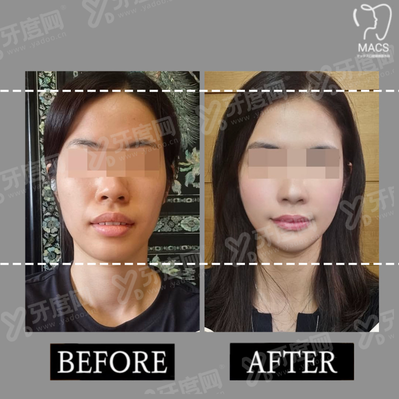 汕头恒医口腔医院地址在哪里？附详细地址+真实患者评价+价格表，看牙攻略快收好！