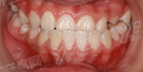 三、新乡拜博口腔医院地址在哪里？（交通便利，周边配套齐全）yanke.yadoo.cn