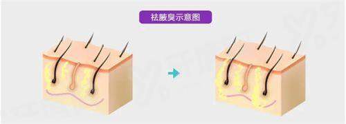 二、北京王恒医生修复双眼皮怎么样yanke.yadoo.cn