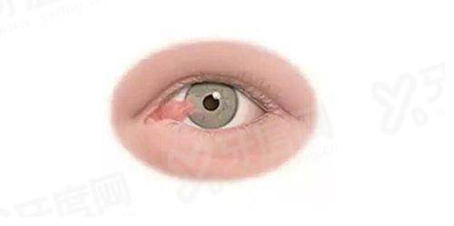 邯郸爱眼医院做斜视手术如何？安全高效优势多，4k元起地址在丛台区！