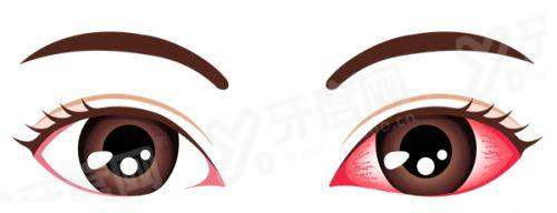 重庆佰视佳眼科在哪？江北区详细地址+患者真实好评！预约挂号超全攻略速藏