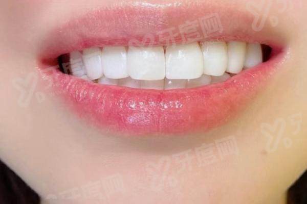 做牙冠一般建议选什么样的材料？二氧化锆全瓷冠！3000-8000元/颗美观耐用超划算