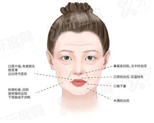 三、上海杨建国注射鼻基底预约挂号攻略？yanke.yadoo.cn