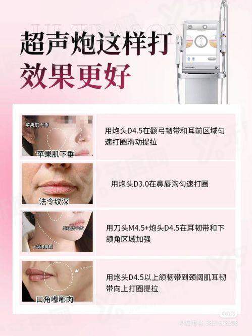 一、上海杨建国注射鼻基底怎么样？yanke.yadoo.cn