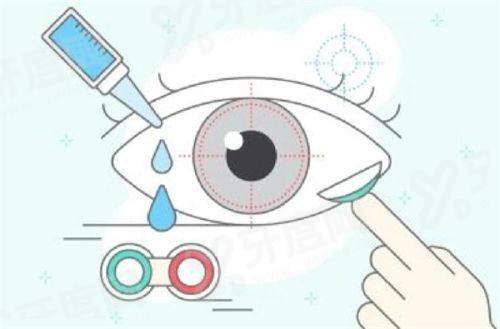 二、东莞爱尔眼科医院近视手术价格yanke.yadoo.cn