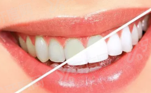 上海私人牙科诊所排名前十名：维乐/美奥/鼎植永博口腔医院排名前三名