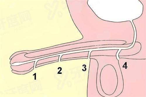 二、王春虎医生苹果肌提升有做的吗yanke.yadoo.cn