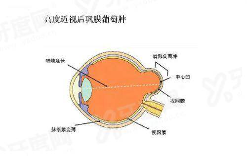 沈阳有8个爱尔眼科医院吗？是的，一城八院附询问电话号码