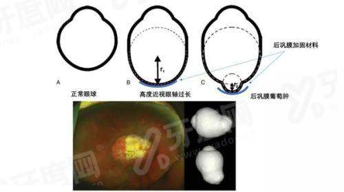 二、河北省二院眼科价格表?(收费合理,透明公开)yanke.yadoo.cn