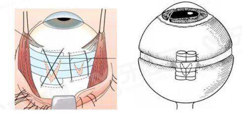 新疆四七四医院眼科预约挂号攻略：4种挂号方式公布附价格表+地址全攻略