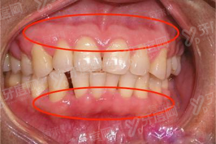 上海金山区种植牙医院排名榜前十名：金一/诺德/峰煜口腔医院排名前三名