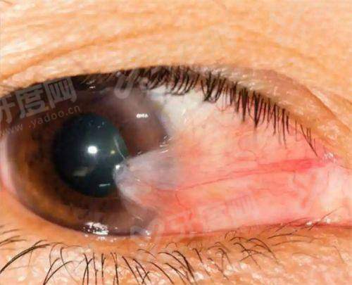 二、北京同仁医院付晶技术怎么样？专精领域经验多yanke.yadoo.cn