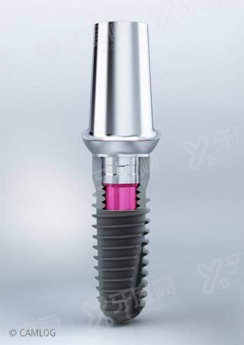 德国camlog种植体是几线品牌？属于中高端二线品牌，使用寿命在20年以上