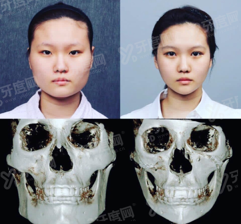 曾翾医生在哪里坐诊？她在上海爱度整形医院，是眼部整形及面部年轻化专家