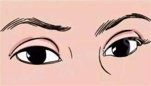 董瑞芳是郑州哪家医院的？有自然灵动的“三生美眼”，双眼皮修复靠谱，价格2000起