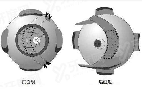 河北邢台眼科医院全国排名第几？实力不容小觑，公布预约挂号/电话
