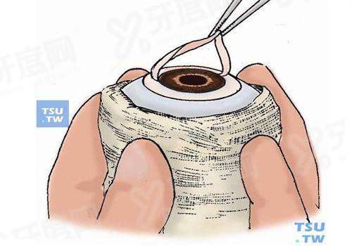 三、烟台康爱眼科医院价格表？（热门项目收费标准参考）yanke.yadoo.cn