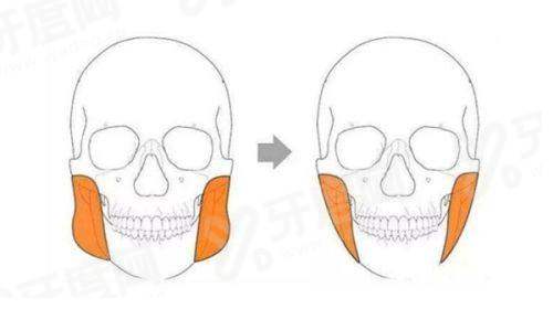 潘博医生耳再造手术怎么样？权威专家20余年经验，价格1万起，附预约挂号攻略
