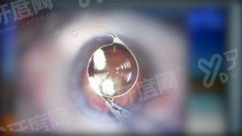 二、郑州二院眼科医生坐诊时间表yanke.yadoo.cn