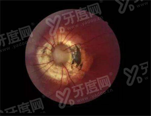 南阳尖峰眼科医院地址在哪？附详细地址+口碑评价+价格表