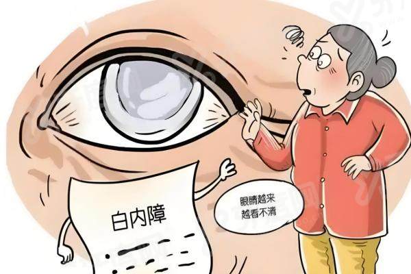 东莞爱尔眼科做白内障手术靠谱吗？专业团队+先进技术，术后视力提升显著恢复快