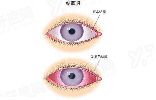 二、沧州爱尔眼科医院怎么样?(医生经验较丰富,设备精良,服务优质)yanke.yadoo.cn