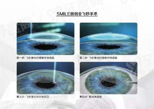 二、石家庄复明眼科医院价格表?(各项眼科项目收费合理透明)yanke.yadoo.cn