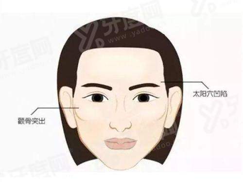 二、刘宾腹壁整形口碑怎样yanke.yadoo.cn