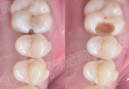 二、上海鑫齿口腔医院怎么样？（正规靠谱，技术设备精良）yanke.yadoo.cn