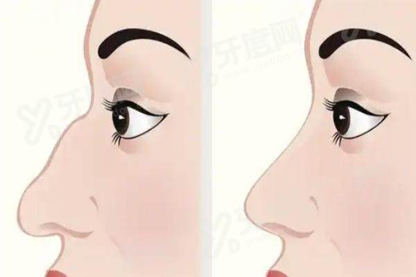 武汉做鼻子有名气的医生排名？武汉艺星、武汉美莱、武汉亚韩这三家医院的医生都上榜啦，快来看！